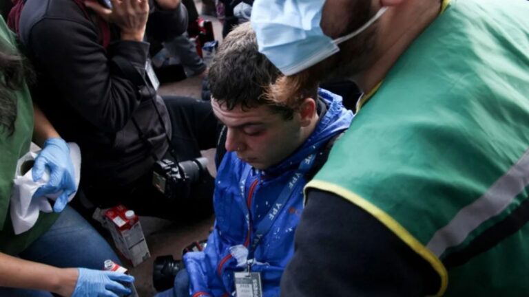 Según Lilia Lemoine, el fotógrafo reprimido por la Policía «interceptó el gas pimienta con la cara»