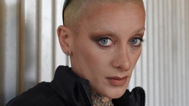 Furia Scaglione se hizo otro retoque estético y en las redes la mataron