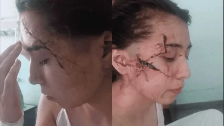 Brutal ataque a cuchillazos a una adolescente en San Cristóbal: le desfiguraron la cara
